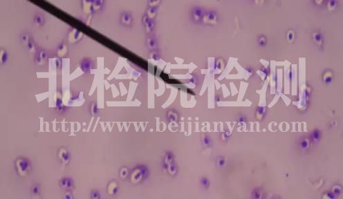 莢膜多糖檢測